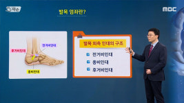 [약손+] 족부질환의 진단과 치료 ⑫염좌란?