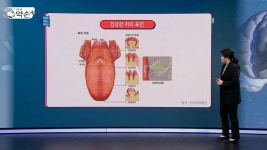 [약손+] 내 몸이 보내는 건강 신호 ‘혀 질환’ ①혀의 구조와 건강한 혀 표면