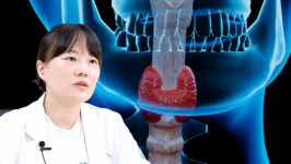 갑상선암은 무조건 수술해야할까?
