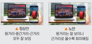 근거리 시력이 떨어지는 노안, 시야 전체가 뿌예지는 백내장