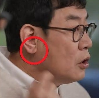 이경규도 심장 철렁…‘귓불 주름’ 뇌출혈·심근경색 경고 신호?