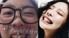 제니·이영지 따라서 치아에 ‘이것’ 했다간…
