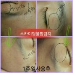 -볼륨O2테라피에센스