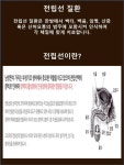 성클리닉-삼성역 아셈한의원