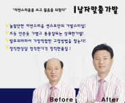 남자가발-광주맞춤가발