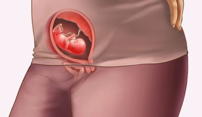 미국 첫 자궁이식 수술 실패…