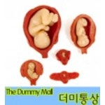 자궁내 태아모형 (27007) : 의료기상사