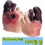 병든 발모형 (WA21216) : 의료기상사