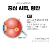 경희 루테인 아스타잔틴400 감마리놀렌산 헤마토코쿠스 비타민A 2월분 : 참웰빙하우스
