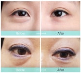 새롭게 선보이는 눈밑지방 화장품 리메스카 아이백 본사발송 : 셀러랜드