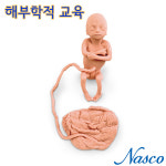 NASCO USA 20주 태아모형 Female 여아 LF00829 : 의료기상사