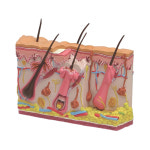 미국 피부모형 양면 정상과 여드름피부 G3751 : 위너메디칼