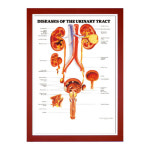 3D 비뇨기의질환 인체해부도- 9797(차트형) : 메디기프트