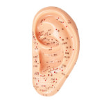 귀지압패치 이혈기석 다이어트 지압기 이혈 테라피 혈자리 마사지 : 싹쓸이 마켓