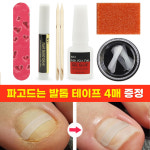 굽은발톱/파고드는 발톱 케어 팁 테이프 세트 네일리프트 : 하나뷰티