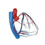 미국 심장 관상동맥 모형 G2575 : 위너메디칼