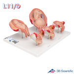 3B Scientific 5단계 태아발달모형 L11/9 태아모형 임신출산교육 : 의료기상사