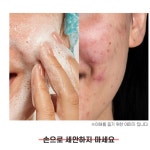에그 몽 진동 실리콘 클렌저 뷰티 클렌징 디바이스 4컬러 : HM굿즈
