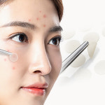 카미케어 여드름패치  습윤밴드 트러블 니들패치 방수 얼굴 상처 흉터 원형 패드형  8mm 10mm 12mm : 고메디칼