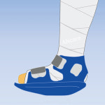 유에이디 ★하블프리★ 기능성 깁스/석고신발 (사이즈 S/M/L) 회색 : 안스케어