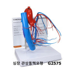 [GPI] 심장 관상동맥모형 G2575 : 케이엠글로벌