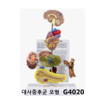 [GPI] 대사증후군 모형 G4020 : 케이엠글로벌