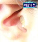 보청기센터 원장이 개발한 울림없는A3음성증폭기/ 보청기배터리, 습기제 ,소음방지귀마개, 쇼핑백 제공 : 주식회사 맑음히어링테크
