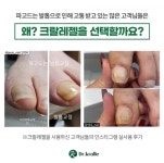 닥터크랄레 크랄레젤 미니3종 세트 6ml 파고드는발톱 손톱 페디케어 레진젤 C커브손발톱 : 윤슬코스메틱