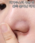 매드스킨케어 피지제거 인어프랙션 블랙헤드 모공팩 연화제MAD : 윈윈픽