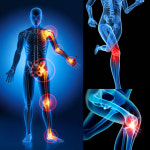 [정품판매처 정품스토어] NEW 라파402VIP 3세트 식약처허가 관절염치료기 라파메디칼 : 하이리빙 e