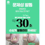 발케어 전문브랜드 닥터크랄레 페디세이버 15ml 문제성발톱 케어 발건강 홈케어 : 언제나맑음  스토어