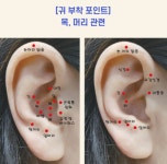 귀지압패치 귀혈자리 귀마사지 이혈테라피 침 점 : 유지상회