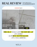 노라 비듬 탈모샴푸 & 헤어트리트먼트 세트 : Yoonbling