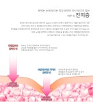 닥터 메디즈 매직키트 : 아마란스피누스 해외지점