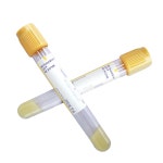 BD진공채혈관 Vacutainer SST PLH tube 5mL 100개 367986 : 부림약품