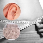 이혈침 귀지압패치 이혈기석 이혈테라피 다이어트귀침 귀침 귀이침 이혈테이프 : 다2쏭