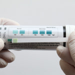 요산 자가진단키트 요산수치 측정기 통풍 퓨린 소변검사 스틱형 CE인증품 25매 : UCC CARE