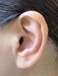 젊은난청인 소음성난청 제레나 초소형보청기 귓속형 스위스보청기 좌측 : 주식회사 맑음히어링테크