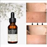 SOME BY MI Galactomyces 퓨어 비타 미 n C 글로우 세럼 30g 화이트닝 페이스 에센스 다크 스팟 리무버 모이스처라이징 스무딩 : hansol.co