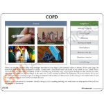 -미국산/COPD모형 G313/보건교육 : 종로상사