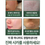병풀잎수 여드름압출후 여드름흉터 색소침착 피부진정 케어 피부과레이저 재생 시카크림 50g : 초록숲도깨비