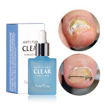 뷰젤 페디베네 안티펑 클리어 네일에센스 10ml 문제성발톱 발톱 클리너 세정제 : 네일재료쇼핑몰네일아이