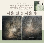 (탈모전문) 엑소힐 엑소좀 탈모기능성 헤어세트 병원입점제품 : 지야뷰티몰