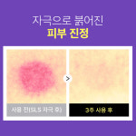 더마펌 수딩 리페어 토너 R4 [200ml] 피부열감 급속진정 수분충전 : 더마펌