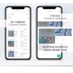 무선 두피현미경 디지털 두피진단기 렌즈 모공 검사기 : 프라우드 해외배송