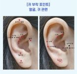 이혈침 이혈기석 이혈테라피 귀침혈자리 귀혈자리 귀지압패치 : 품다의 상점