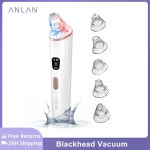 여드름 압출기 ANLAN 진공 블랙헤드 제거기 레드 블루 라이트 모공 클리너 IPX5 방수 블랙 헤드 페이셜 클리닝 : 화이트벨라