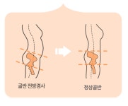앞 골반 마사지 기 체형 교정 혈액 순환 노폐물 배출 하복부 림프 발란스A 밸런스A : twosso