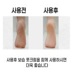 갈라진 뒷꿈지를 매끈하게 양면 발각질제거 풋파일 : 긴이야기