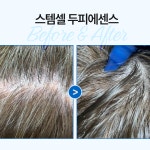 안달로우 아르간 스템셀 가려움 해결 민감성 두피 에센스 세럼 62ml, 3개 : 안달로우 코리아